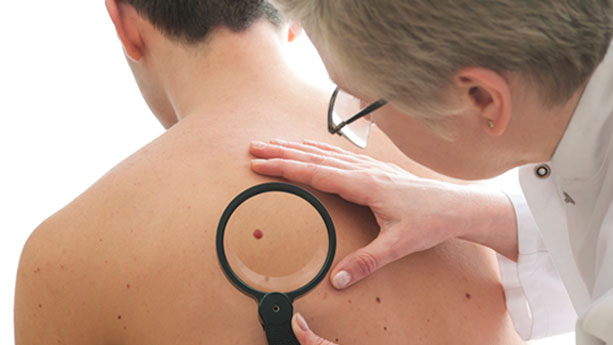 Doctor performing mole check on patient